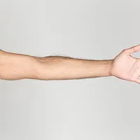 Arm