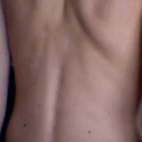 Back/Waist