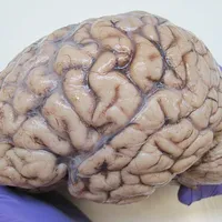 Brain