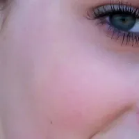 Cheek