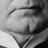 Chin