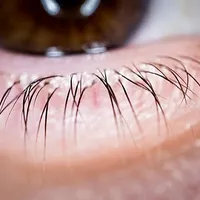 Eyelash