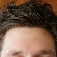 Forehead
