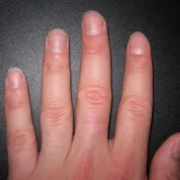 Nail