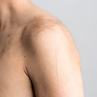 Shoulder