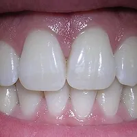 Teeth
