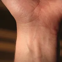 Wrist