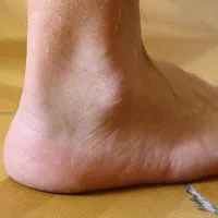 Ankle