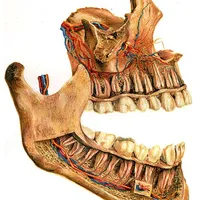 Jaw