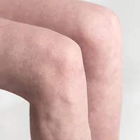 Knee