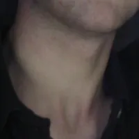 Neck