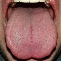 Tongue